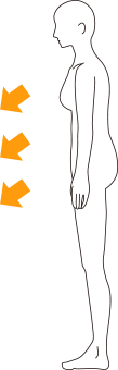反り腰の原因