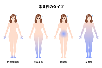 冷え性とは?