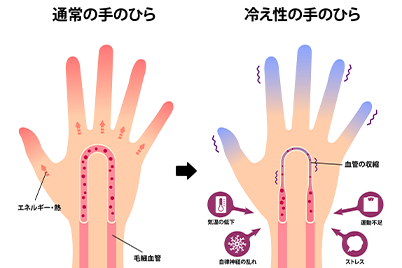 冷え性の原因